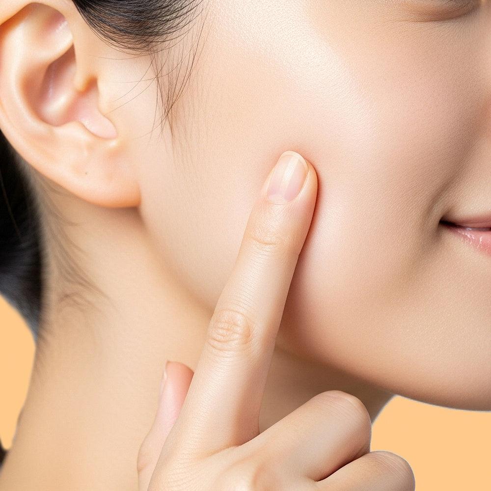 Acne Care