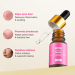 KLYRE Anti-Acne Serum bottle with dropper on a light pink background
